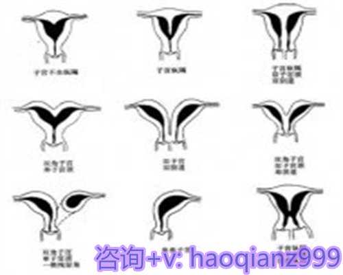 泰国三代试管助孕得多少钱？