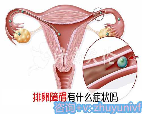 第一次试管婴儿移植失败后必须刮宫吗?