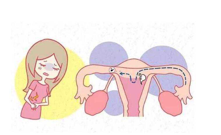 做供卵试管可以选择哪些国家？做足功课，千万别被骗