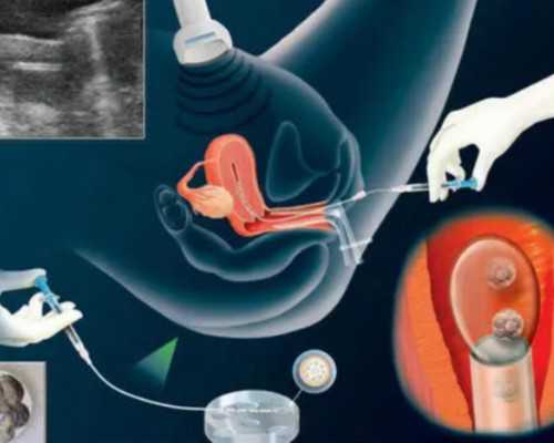 天津供卵试管生儿子，做试管婴儿建档后的流程[试管建档流程]