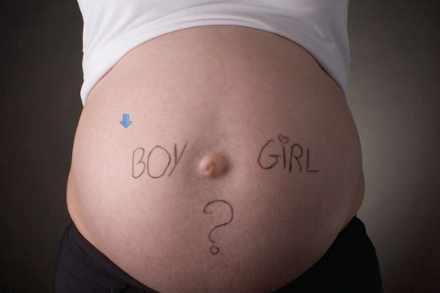 怎样预防子宫内膜异位症