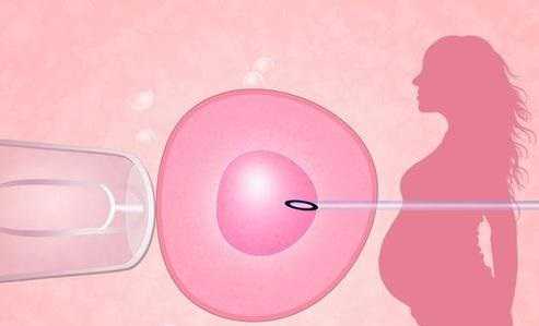 天津助孕妈妈qq,1试管婴儿需要多少费用